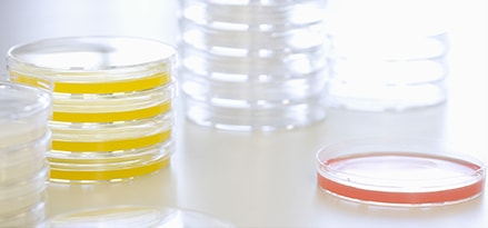Red and yellow petri dishes